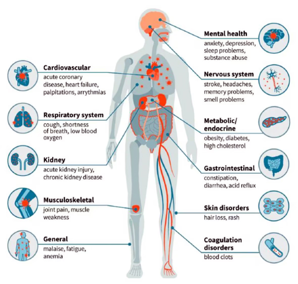COVID infections can result in cardiovascular, respiratory system, kidney, musculoskeletal, general, mental health, nervous system, metabolic/endocrine, gastrointestinal, skin disorders, coagulation disorders.